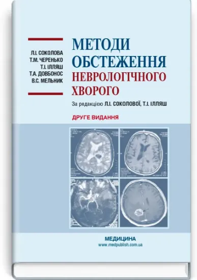 Изображение Методи обстеження неврологічного хворого